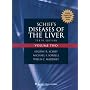 Schiff's Diseases of the Liver (2 Volume Set)