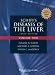 Schiff s Diseases of the Liver (2 Volume Set)