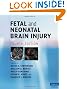 Fetal and Neonatal Brain Injury