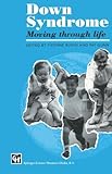 Down syndrome : moving through life