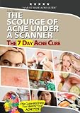 The7dayacnecure, The Scourge of Acne Under a Scanner