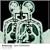 Bodysong [VINYL]