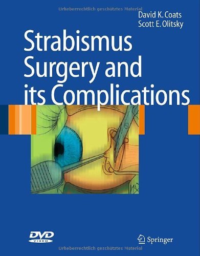 Strabismus Surgery and its Complications On Sale