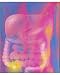 Photographic Print of Computer artwork depicting appendicitis from Science Photo Library