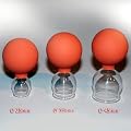 Schr�pfgl�ser 3 im SET 25-35-45 mit Saugball Schr�pfglas Feuerlos NEU