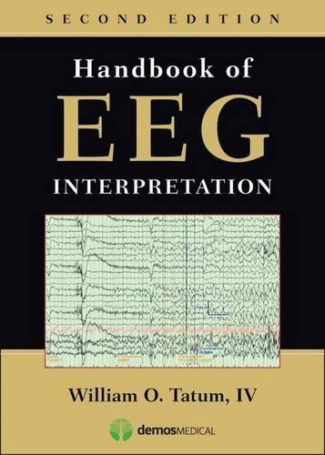 Handbook of EEG Interpretation, Second Edition by Tatum IV DO, William (2014) Paperback