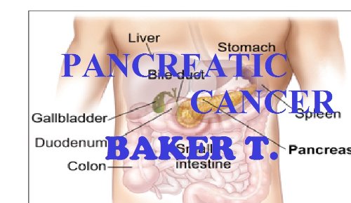 Pancreatic Cancer (WHAT YOU NEED TO KNOW Book 6)