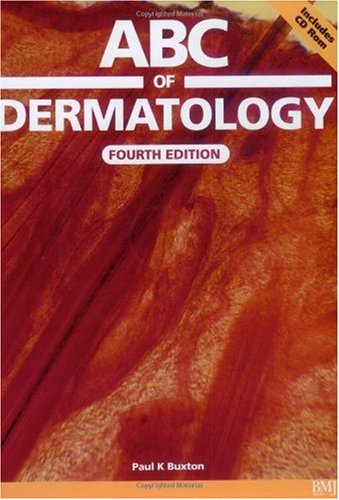 ABC of Dermatology with CD-ROM (ABC Series)