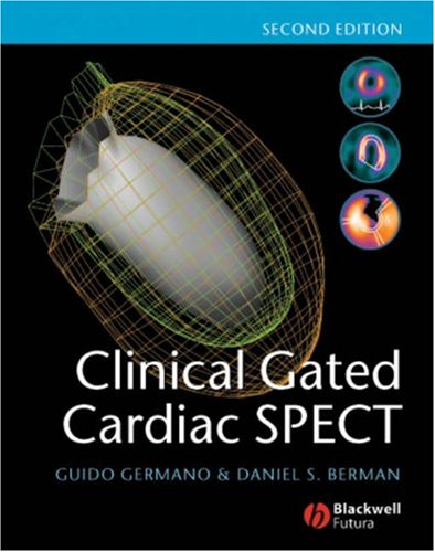 Coronary-Disease
