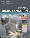 Kidney Transplantation: Principles and Practice (Morris,Kidney Transplantation)