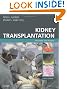 Kidney Transplantation: Principles and Practice, 6e (Morris,Kidney Transplantation)