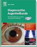 Diagnoseatlas Augenheilkunde: Über 2500 Abbildungen zu lokalen und systemischen Befunden