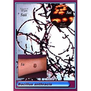 Microbecards: Medical Microbiology and Infectious Diseases Study Cards