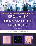 Color Atlas & Synopsis of Sexually Transmitted Diseases, Third Edition (Handsfield, Color Atlas & Synopsis of Sexually Transmitted Diseases)