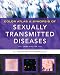 Color Atlas & Synopsis of Sexually Transmitted Diseases, Third Edition (Handsfield, Color Atlas & Synopsis of Sexually Transmitted Diseases)