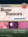 Dahlin's Bone Tumors: General Aspects and Data on 10,165 Cases