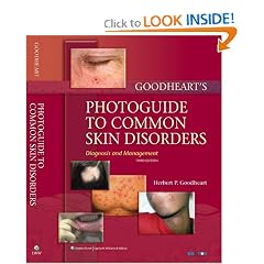 Goodheart's Photoguide to Common Skin Disorders: Diagnosis and Management