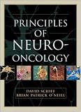 Principles and Practice of Neuro-Oncology