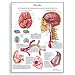 3B Scientific Glossy Paper Stroke Anatomical Chart