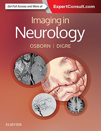 Imaging in Neurology