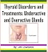 Thyroid Disorders and Treatments: Underactive and Overactive Glands Thyroid Disorders and Treatments: Underactive and Overactive Glands