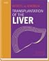 Transplantation of the Liver, 2e