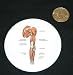 3" button / pin printed with Medical anatomy
