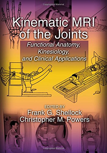 kinematic mri of the joints functional anatomy kinesiology and clinical applications