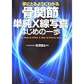 �摜�f�f �Տ���w ��ɂƂ�悤�ɂ킩�鍜�֐ߒP��X���ʐ^ �͂��߂̈��