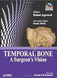 Temporal bone : a surgeon's vision