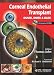 Corneal Endothelial Transplant DSAEK, DMEK & DLEK with Int. DVD-ROM