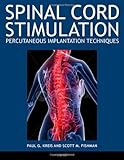 Spinal cord stimulation : percutaneous implantation techniques