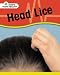 Book Head Lice (How's Your Health?)