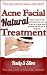 Best natural acne treatments: Acne facial