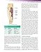 Essentials of Physical Medicine and Rehabilitation: Musculoskeletal Disorders, Pain, and Rehabilitation (Frontera, Essentials of Physical Medicine and Rehabilitation)