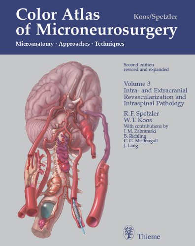 Color Atlas of Microneurosurgery: Microanatomy, Approaches and Techniques: 3