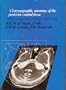 Cisternographic Anatomy of the Posterior Cranial Fossa: High Resolution Ct and Mri Study