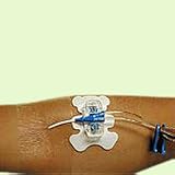 Bard StatLock PICC Plus Pediatric Stabilization Device