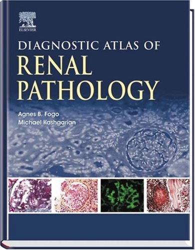 Diagnostic Atlas of Renal Pathology: A Companion to Brenner and Rector s The Kidney 7E