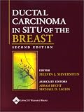 Ductal Carcinoma In Situ of the Breast
