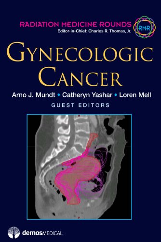 Gynecologic Cancer: 2 (Radiation Medicine Rounds)