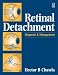 Retinal Detachment: Diagnosis and Management