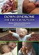 Down Syndrome: The First 18 Months