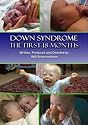 Down Syndrome: The First 18 Months