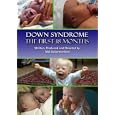 Buy Down Syndrome: The First 18 Months
