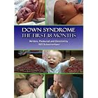 Buy Down Syndrome: The First 18 Months now!