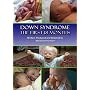 Down Syndrome: The First 18 Months