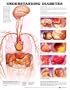 Diabetes Chart Understanding Diabetes