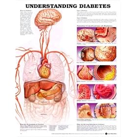 Diabetes Chart Understanding Diabetes