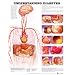 Diabetes Chart Understanding Diabetes